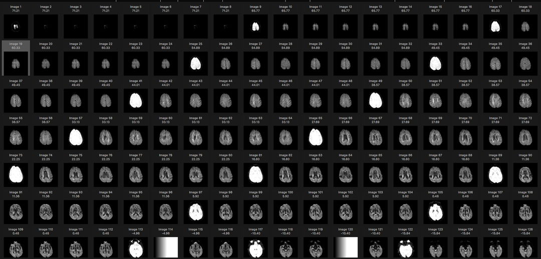 MRI scan series from DICOM folder generated by Osirix software